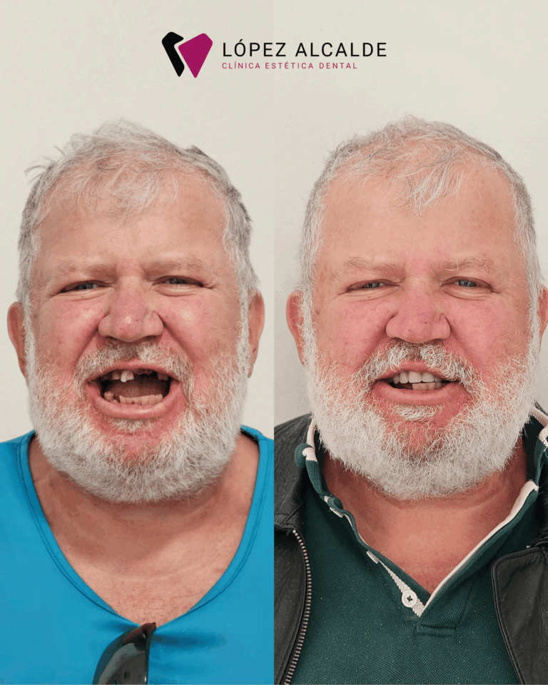 JOSE ANTES Y DSP (3)